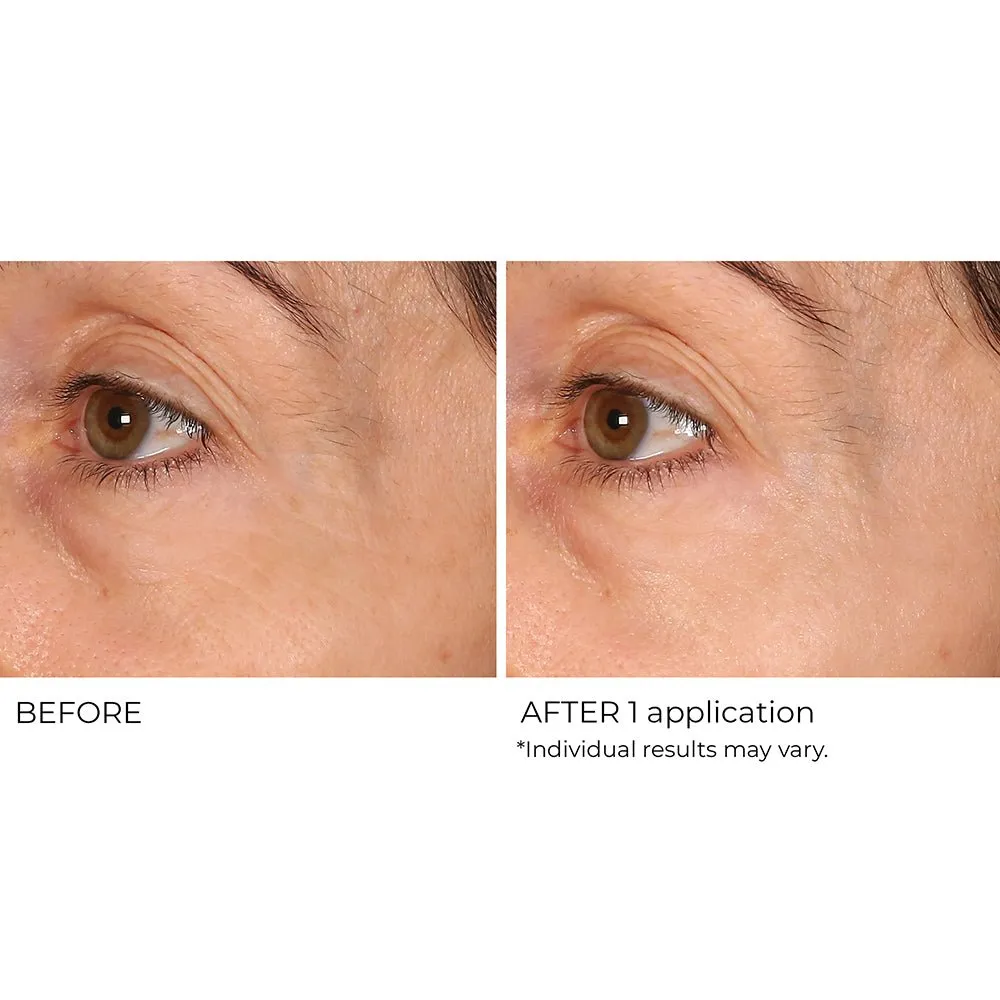 Wrinkle Blur Targeted Treatment