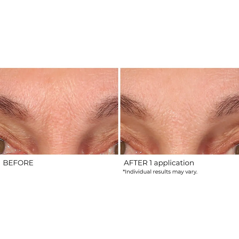 Wrinkle Blur Targeted Treatment